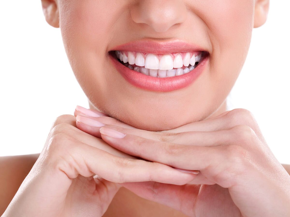 Blanqueamiento dental profesional - sonrisa blanca radiante